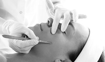 dermaplaning
