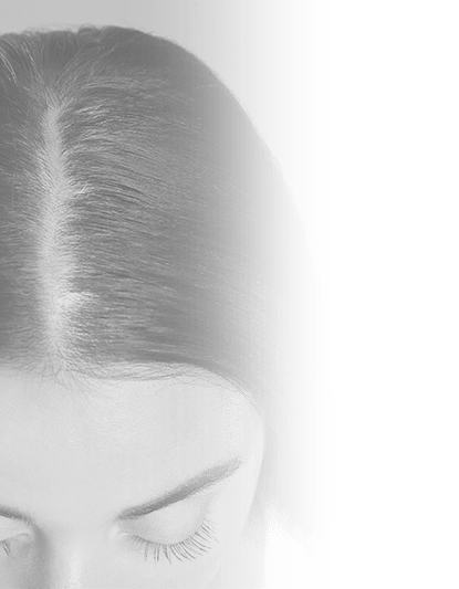 before-after-less_hair-3a