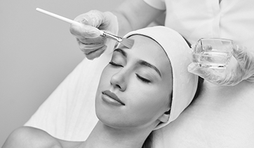 chemical-peel-1