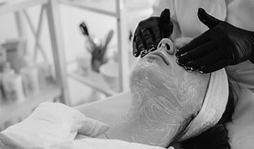 deep-chemical-peel-1