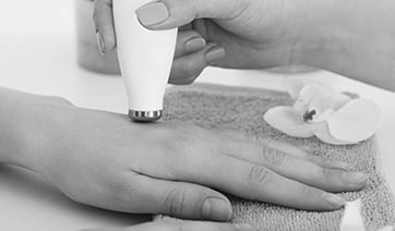hand-microdermabrasion-1