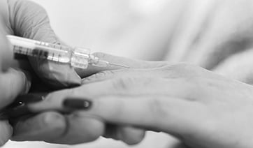 hand-radiesse-1