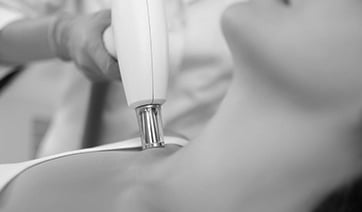 laser-chest-rejuvenation-1