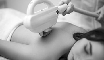 laser-hair-removal-back-1