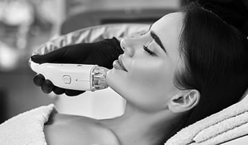 laser-hair-removal-chin-1