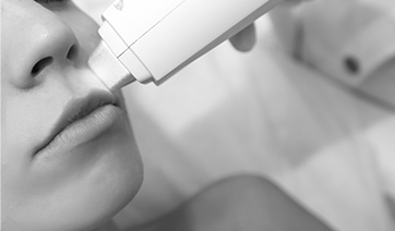laser-resurfacing-1