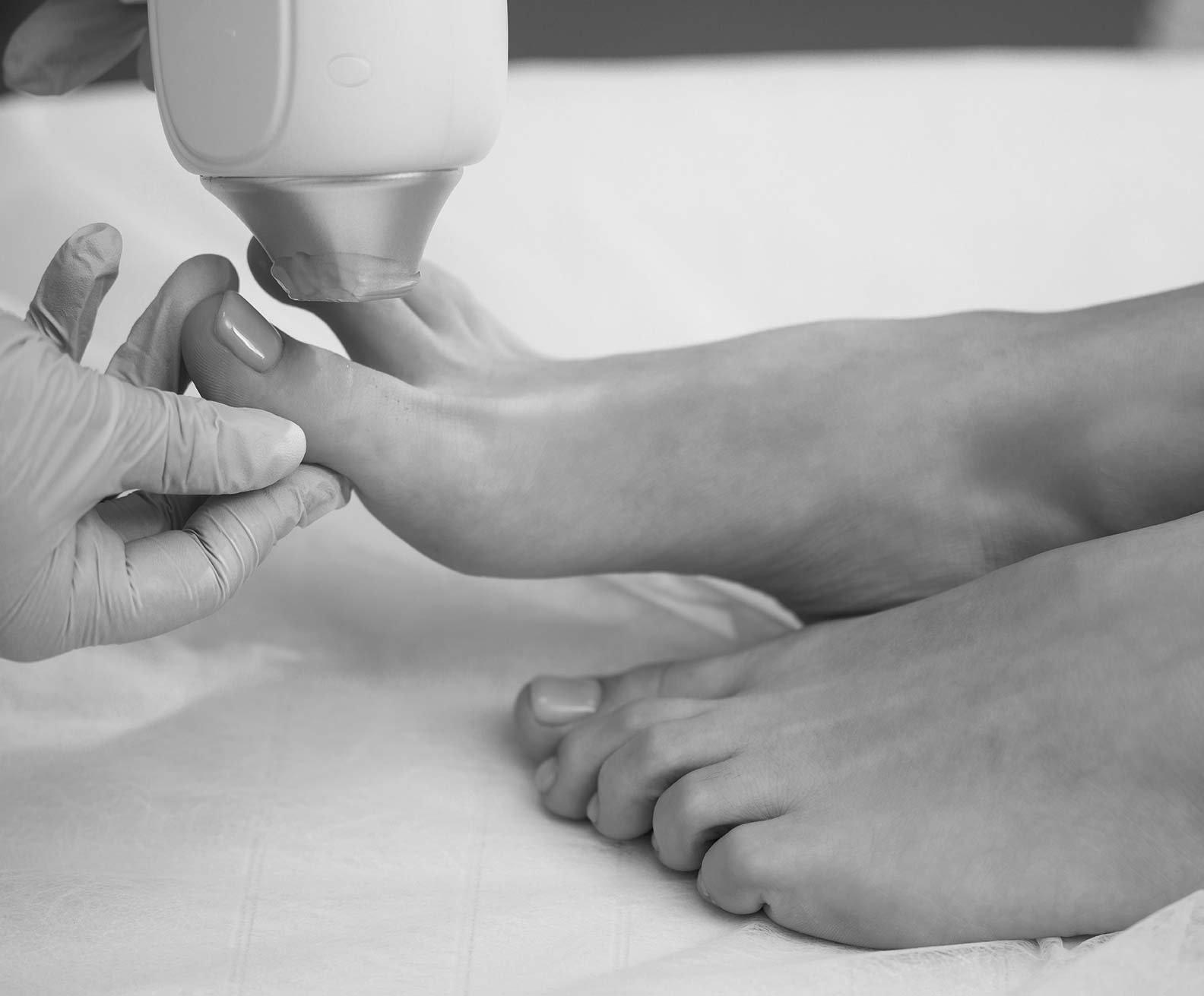 laser-treatment-foot-closeup