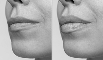 lip-lines-1