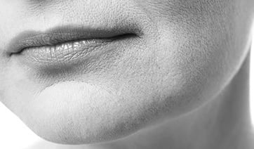 lips-thin-1