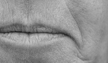 mouth-lines-2