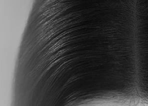 scalp 1