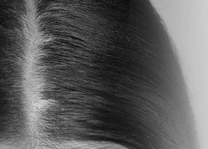 scalp 2