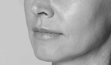 soft-cheekbones-1