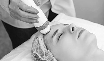 sofwave-treatment-1