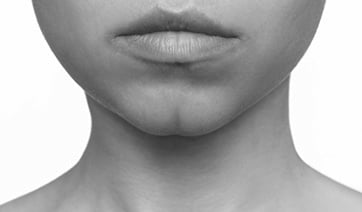 woman-with-cleft-chin-1