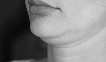woman-with-double-chin-1