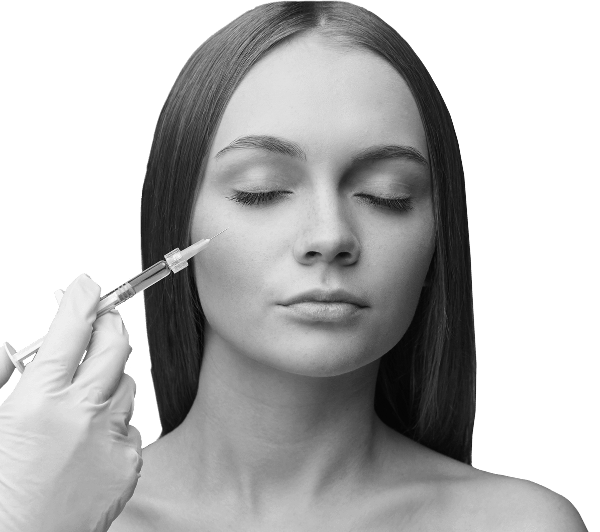 young-woman-dermal-filler-1