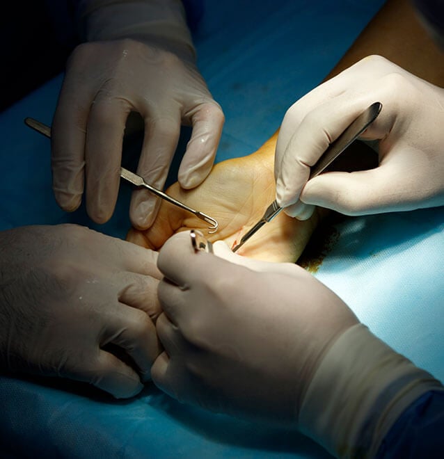 hand surgery